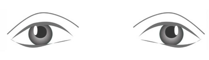 img-blog-a-downturned